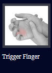 Trigger-Finger